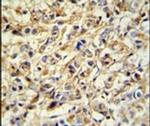 PRELP Antibody in Immunohistochemistry (IHC)