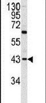 PRELP Antibody in Western Blot (WB)