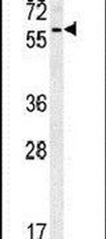 PRELP Antibody in Western Blot (WB)