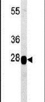 PREPL Antibody in Western Blot (WB)