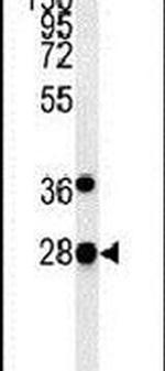 PREPL Antibody in Western Blot (WB)