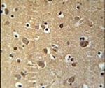 PRG2 Antibody in Immunohistochemistry (IHC)