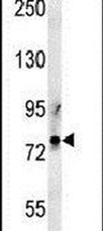 PRG2 Antibody in Western Blot (WB)