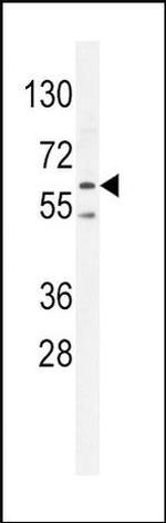 AMPK alpha-2 Antibody in Western Blot (WB)