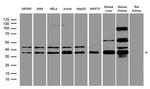 PRKAB1 Antibody in Western Blot (WB)
