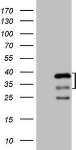 PRKAB2 Antibody in Western Blot (WB)