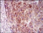 PKA gamma Antibody in Immunohistochemistry (Paraffin) (IHC (P))