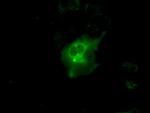 PRKAR1A Antibody in Immunocytochemistry (ICC/IF)
