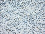 PRKAR1A Antibody in Immunohistochemistry (Paraffin) (IHC (P))