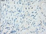 PRKAR1A Antibody in Immunohistochemistry (Paraffin) (IHC (P))