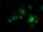 PRKAR1B Antibody in Immunocytochemistry (ICC/IF)