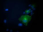 PRKAR1B Antibody in Immunocytochemistry (ICC/IF)