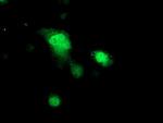 PRKAR1B Antibody in Immunocytochemistry (ICC/IF)