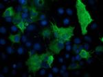 PRKAR1B Antibody in Immunocytochemistry (ICC/IF)