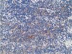 PRKAR1B Antibody in Immunohistochemistry (Paraffin) (IHC (P))