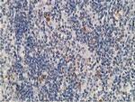 PRKAR1B Antibody in Immunohistochemistry (Paraffin) (IHC (P))