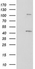 PRKAR1B Antibody in Western Blot (WB)