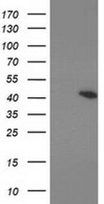 PRKAR1B Antibody in Western Blot (WB)
