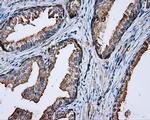 PRKAR2A Antibody in Immunohistochemistry (Paraffin) (IHC (P))