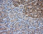 PRKAR2A Antibody in Immunohistochemistry (Paraffin) (IHC (P))
