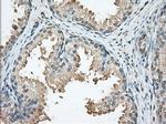 PRKAR2A Antibody in Immunohistochemistry (Paraffin) (IHC (P))
