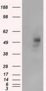 PRKAR2A Antibody in Western Blot (WB)