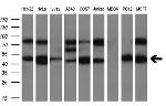 PRKAR2A Antibody in Western Blot (WB)