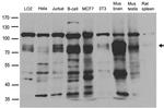 PRKCD Antibody in Western Blot (WB)