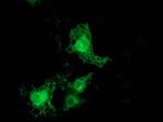 PRKCE Antibody in Immunocytochemistry (ICC/IF)