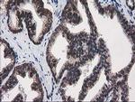 PRKCE Antibody in Immunohistochemistry (Paraffin) (IHC (P))