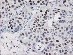 PRKCE Antibody in Immunohistochemistry (Paraffin) (IHC (P))
