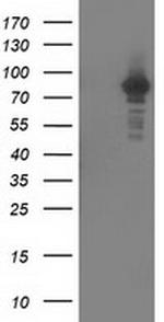 PRKCE Antibody in Western Blot (WB)