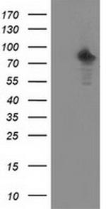 PRKCE Antibody in Western Blot (WB)