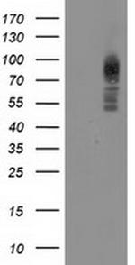 PRKCE Antibody in Western Blot (WB)
