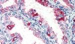 PKC zeta Antibody in Immunohistochemistry (Paraffin) (IHC (P))