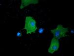 PRKD2 Antibody in Immunocytochemistry (ICC/IF)