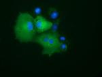 PRKD2 Antibody in Immunocytochemistry (ICC/IF)