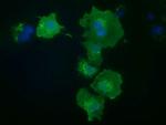 PRKD2 Antibody in Immunocytochemistry (ICC/IF)