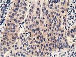 PRKD2 Antibody in Immunohistochemistry (Paraffin) (IHC (P))