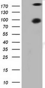 PRKD2 Antibody in Western Blot (WB)
