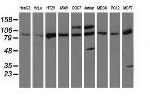 PRKD2 Antibody in Western Blot (WB)