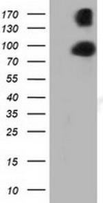 PRKD2 Antibody in Western Blot (WB)