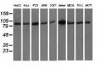 PRKD2 Antibody in Western Blot (WB)