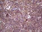 PRKD3 Antibody in Immunohistochemistry (Paraffin) (IHC (P))