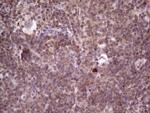 PRKD3 Antibody in Immunohistochemistry (Paraffin) (IHC (P))
