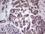 PRKD3 Antibody in Immunohistochemistry (Paraffin) (IHC (P))