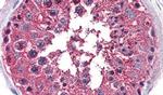 PRKD3 Antibody in Immunohistochemistry (Paraffin) (IHC (P))