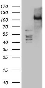 PRKD3 Antibody in Western Blot (WB)