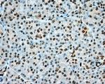 PRKG1 Antibody in Immunohistochemistry (Paraffin) (IHC (P))