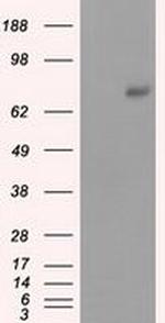 PRKG1 Antibody in Western Blot (WB)